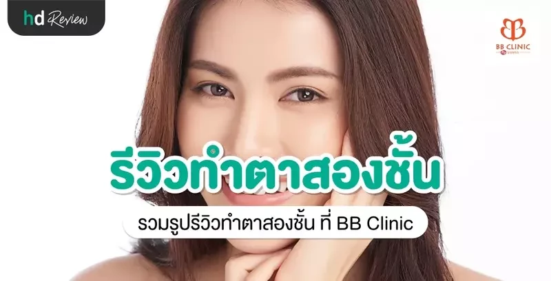 รีวิว ทำตาสองชั้น ที่ BB Clinic