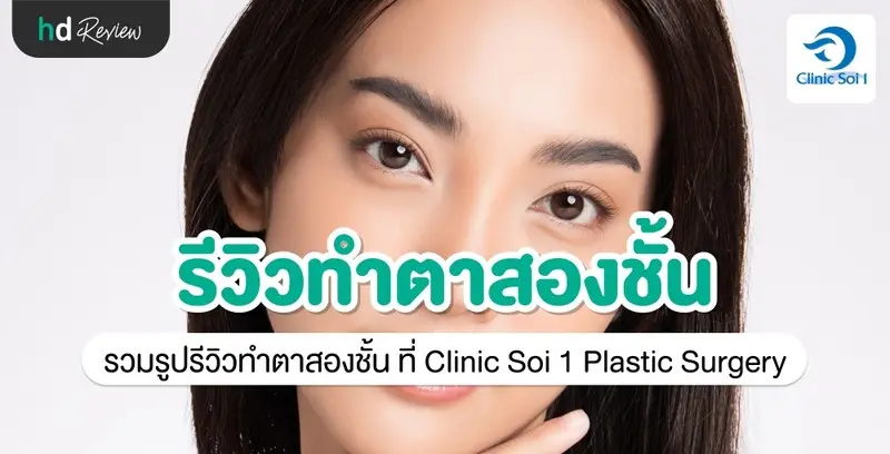 รีวิว ทำตาสองชั้น ที่ Clinic Soi 1 Plastic Surgery