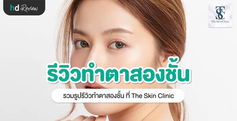 รีวิว ทำตาสองชั้น ที่ The Skin Clinic