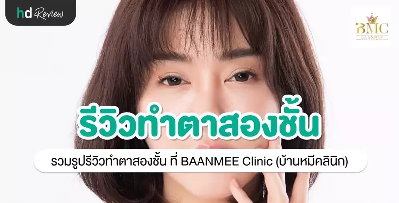รีวิว ทำตาสองชั้น ที่ BAANMEE Clinic (บ้านหมีคลินิก)