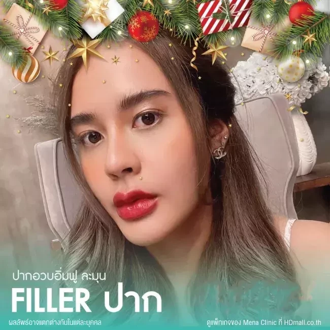 รีวิว ฉีดฟิลเลอร์ปาก ที่ Mena Clinic