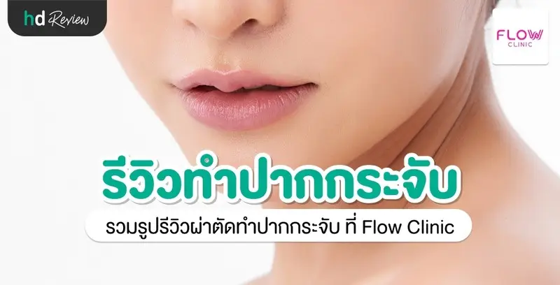 รีวิว ผ่าตัดทำปากกระจับ ที่ Flow Clinic