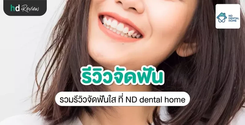 รีวิว จัดฟัน ที่ ND dental home