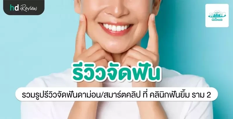 รีวิว จัดฟัน Smart Clip ที่ คลินิกฟันยิ้ม ราม 2