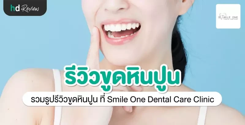 รีวิว ขูดหินปูน ที่ Smile One Dental Care Clinic