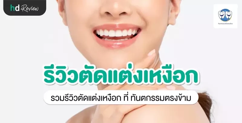 รีวิว ตัดแต่งเหงือก ที่ ทันตกรรมตรงข้าม