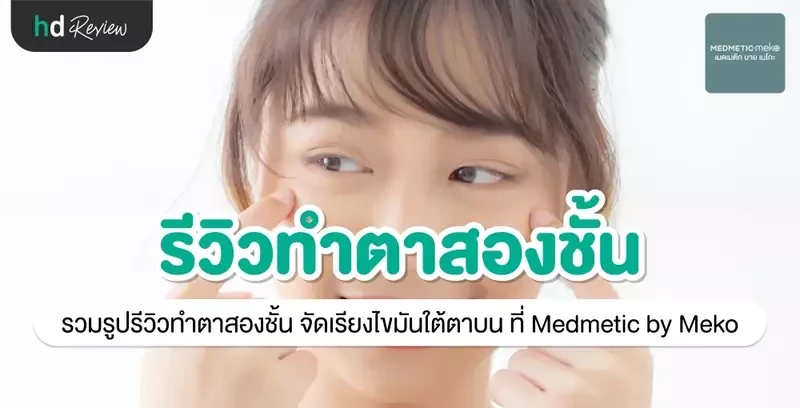 รีวิว ทำตาสองชั้น จัดเรียงไขมันใต้ตาบน ที่ Medmetic by Meko