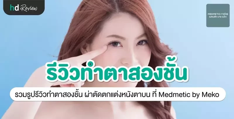 รีวิว ทำตา ผ่าตัดตกแต่งหนังตาบน ที่ Medmetic by Meko