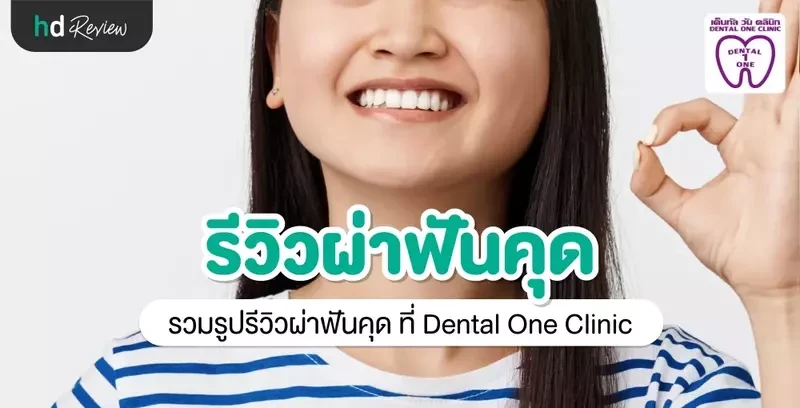 รีวิว ผ่าฟันคุด ที่ Dental One Clinic