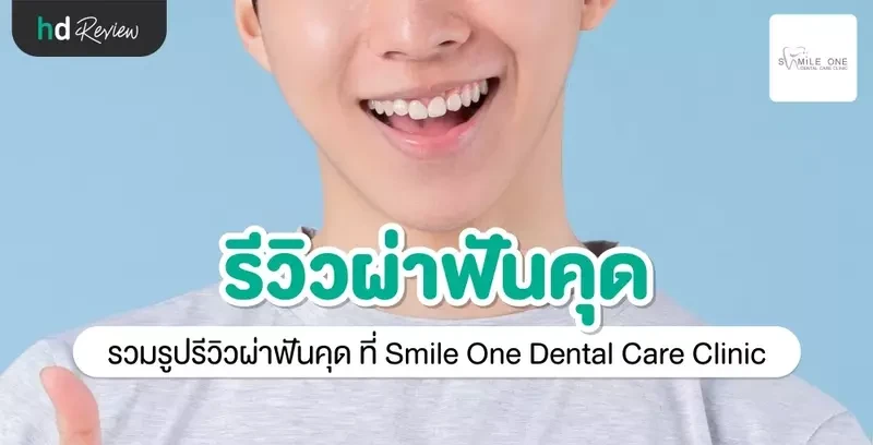 รีวิว ผ่าฟันคุด ที่ Smile One Dental Care Clinic