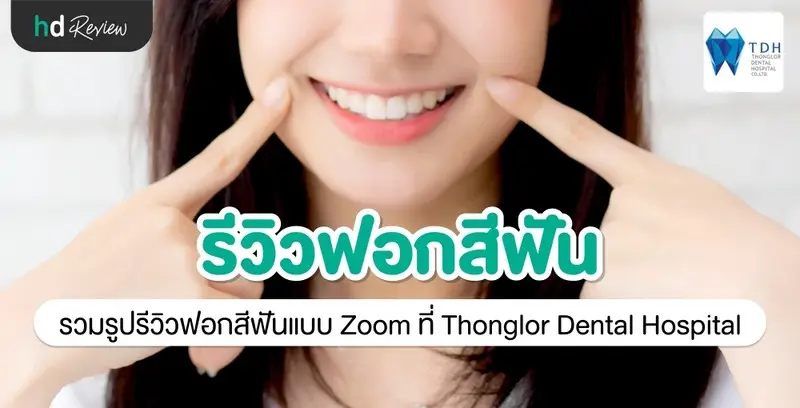 รีวิว ฟอกสีฟันแบบ Zoom ที่ Thonglor Dental Hospital (TDH)