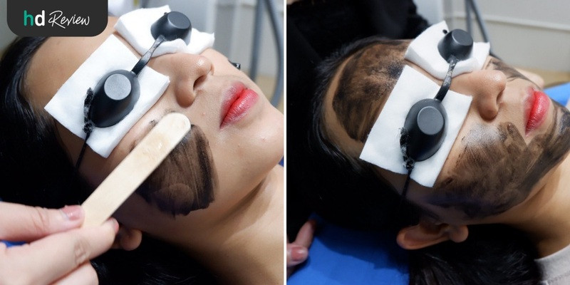 รีวิว Carbon Peel Laser ฟื้นฟูผิว กระชับรูขุมขน ฝ้ากระ ที่ Divine Aesthetic Clinic
