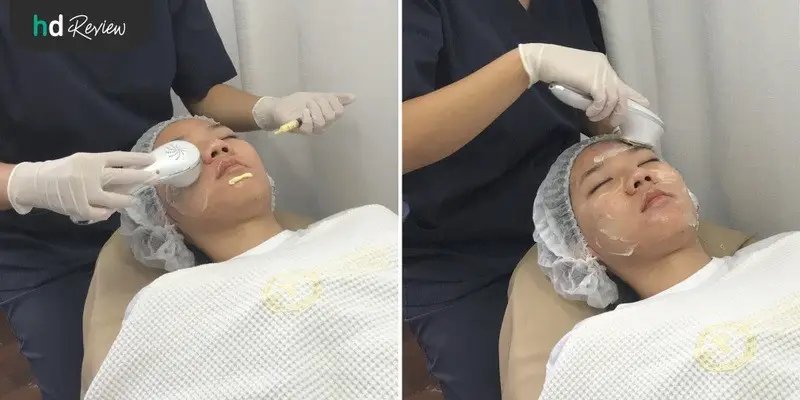 ขั้นตอนการทำ Carbon Peel Laser ผลัดเซลล์หน้าใส ที่ Punnisa Clinic