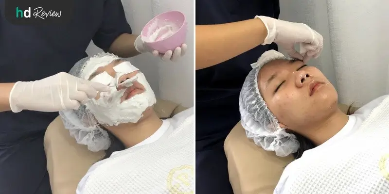 ขั้นตอนการทำ Carbon Peel Laser ผลัดเซลล์หน้าใส ที่ Punnisa Clinic