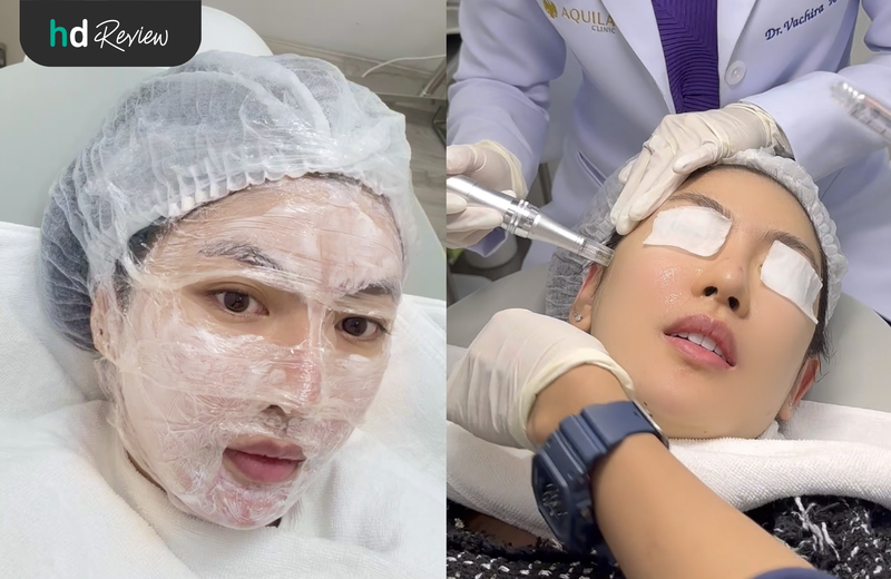 ขั้นตอนการฉีด Chanel Glow