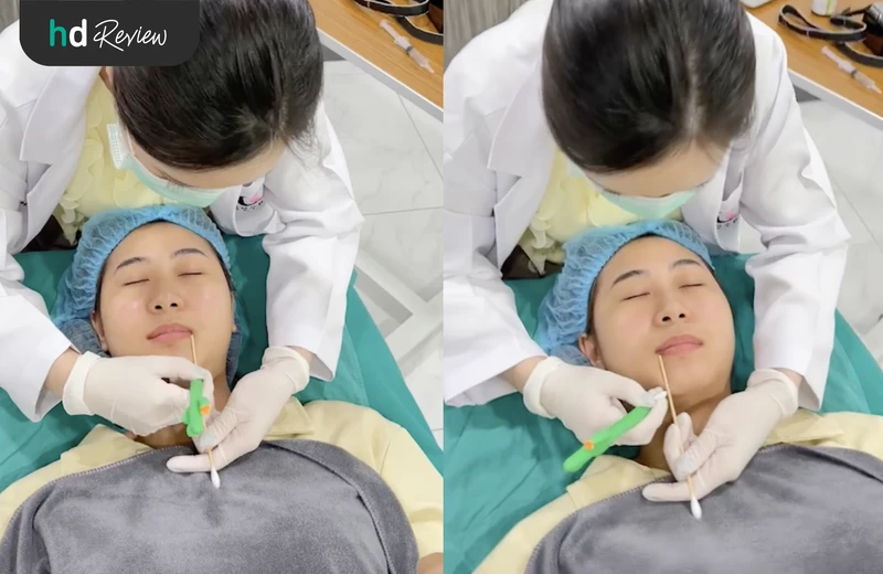 ขั้นตอนการเสริมคาง ที่ Chanya Clinic