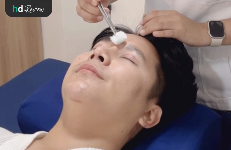 ฝังเข็มเจ็บมั้ย?