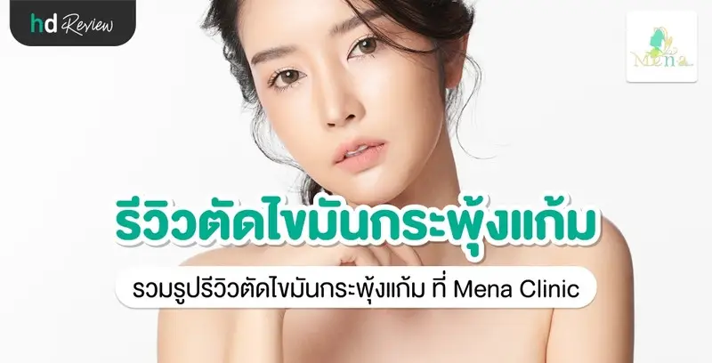 รีวิว ตัดไขมันกระพุ้งแก้ม ที่ Mena Clinic
