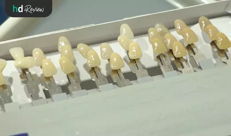 วีเนียร์สำหรับแปะผิวฟัน ที่ Grace Dental Clinic