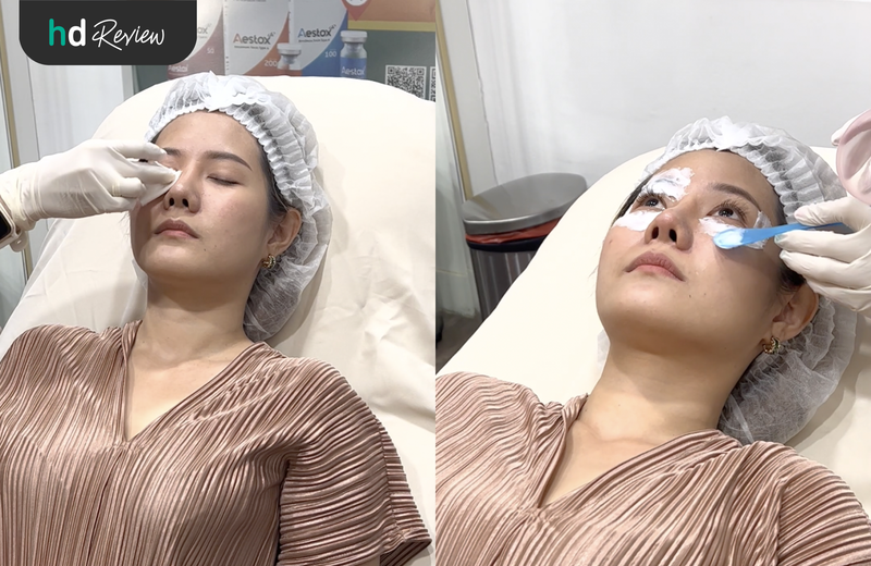 ขั้นตอนการเตรียมตัวก่อนทำ Thermage Eyes
