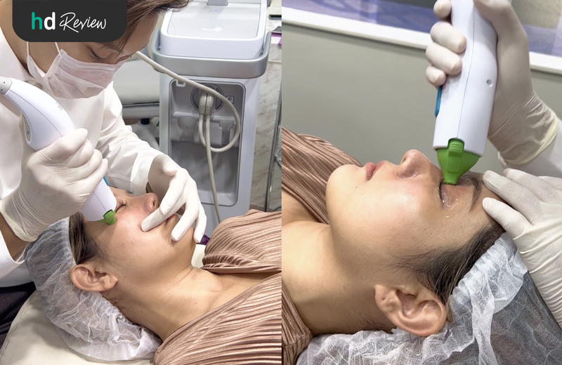 ขั้นตอนการทำ Thermage Eyes ยกกระชับผิว ลดรอยคล้ำรอบดวงตา