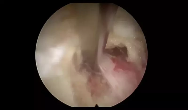 ภาพตัวอย่างจากกล้อง Endoscope