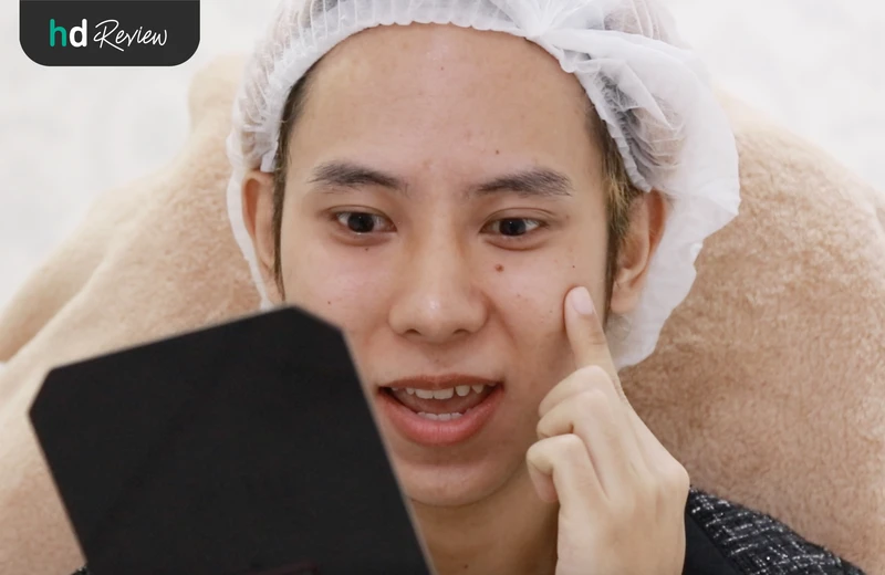 หลังฉีดฟื้นฟูใต้ตาคล้ำ Eye Stem