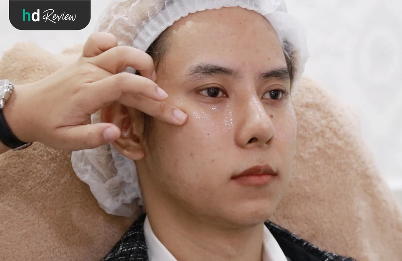 ขั้นตอนการเช็ดทำความสะอาดเครื่องสำอางค์ก่อนฉีด Eye Stem