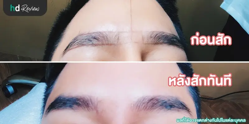 รีวิว สักคิ้วผู้ชาย แบบธรรมชาติ ที่ Baramee Beauty