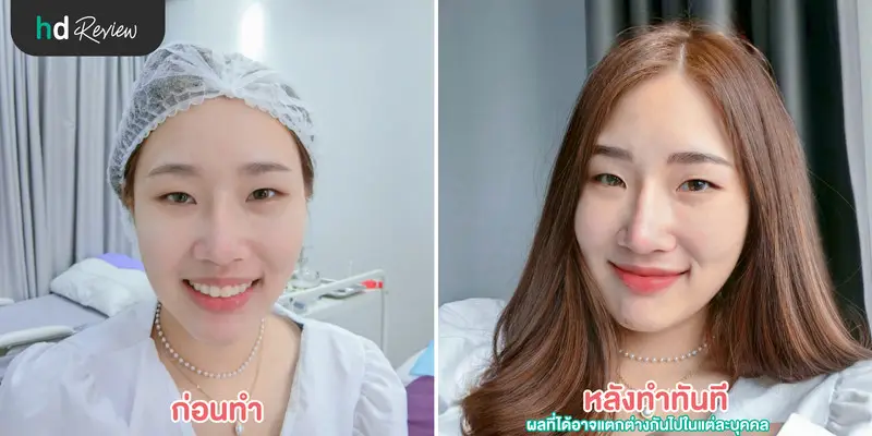 HDreview รีวิว สักคิ้ว