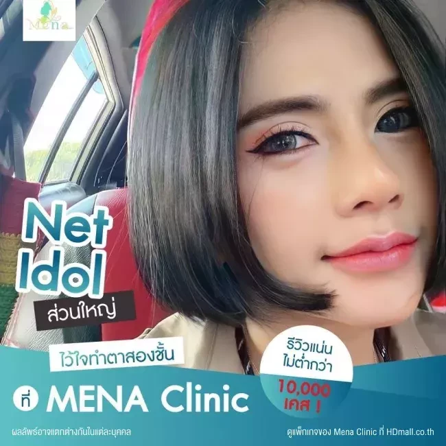 รีวิว ทำตาสองชั้นแบบกรีดยาว พร้อมตกแต่งไขมัน ที่ Mena Clinic