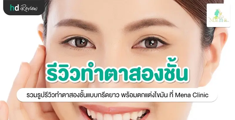 รีวิว ทำตาสองชั้นแบบกรีดยาว พร้อมตกแต่งไขมัน ที่ Mena Clinic