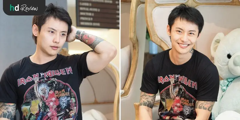 รีวิว ปลูกผม แบบ FUE ที่ Dermaster