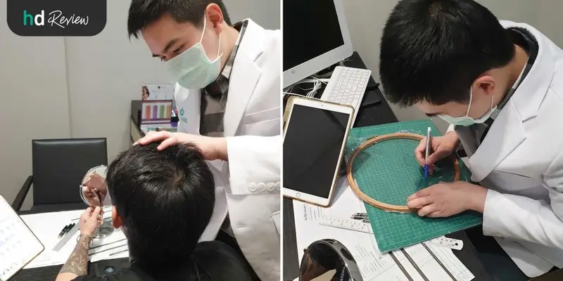 รีวิว ปลูกผม แบบ FUE ที่ Dermaster