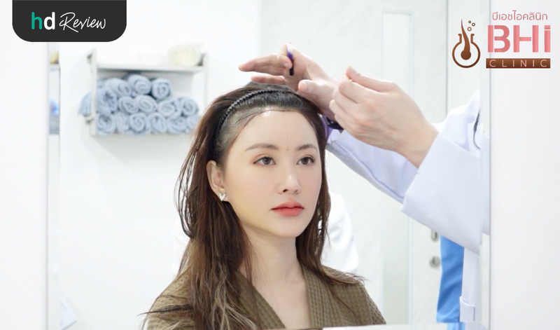 ประเมินก่อนปลูกผมแบบ FUE ที่ BHI Clinic