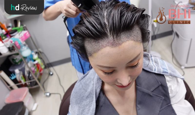 หลังปลูกผมแบบ FUE ทันทีที่ BHI Clinic