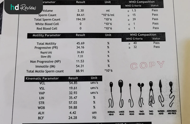ผลตรวจความแข็งแรงของสเปิร์มโดยระบบ AI