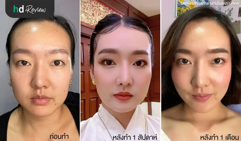 ผลลัพธ์หลังจากทำ 1 อาทิตย์