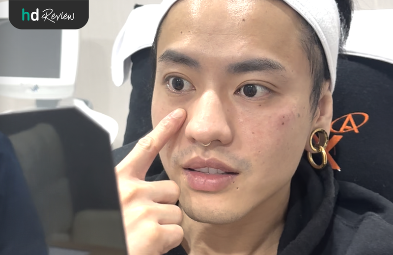 ฉีดฟิลเลอร์ใต้ตา เจ็บมั้ย?