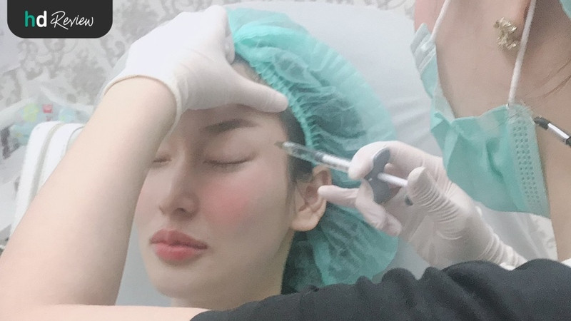 content review injectable fillers juvederm temples and lips at wink clinic by paranya lapudomsakul 4