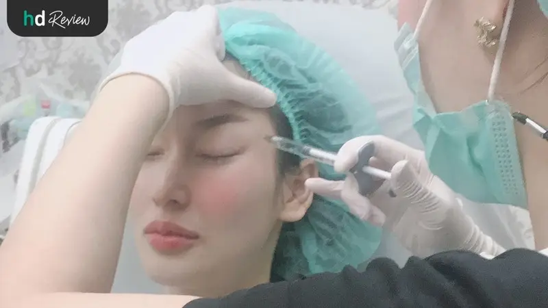 content review injectable fillers juvederm temples and lips at wink clinic by paranya lapudomsakul 4