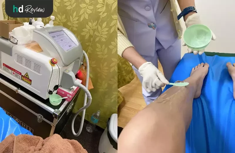 ขั้นตอนการกำจัดขนขาล่าง ด้วย Diode Laser ที่ Cher Clinic
