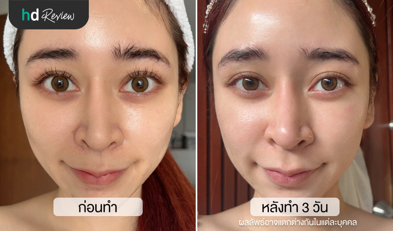 content review korean skin secret at mine clinic by pipimwila wongprathed 10