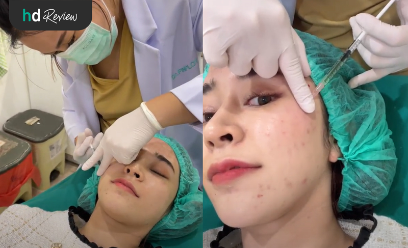 content review korean skin secret at mine clinic by pipimwila wongprathed 9