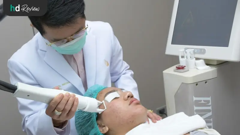 รีวิว เลเซอร์ FINE SCAN 1550 รักษาหลุมสิว ที่ Clinic Neo