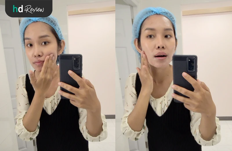 ขั้นตอนการเตรียมตัวก่อนทำปากกระจับ