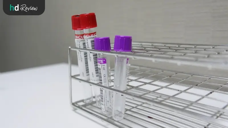 รีวิวตรวจ Micronutrient Profile และ วิตามิน D2/D3 ที่ N-Health