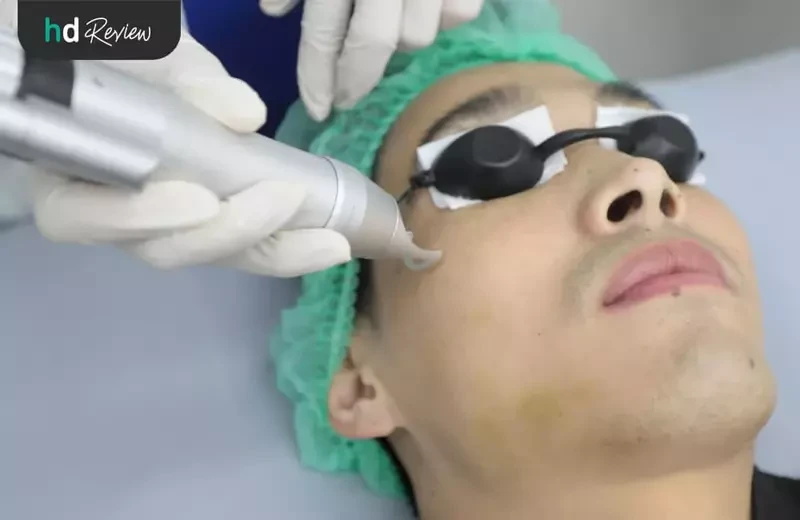 ขั้นตอนการเลเซอร์รักษาฝ้า ด้วย Picocare 450 ที่ Flow Clinic