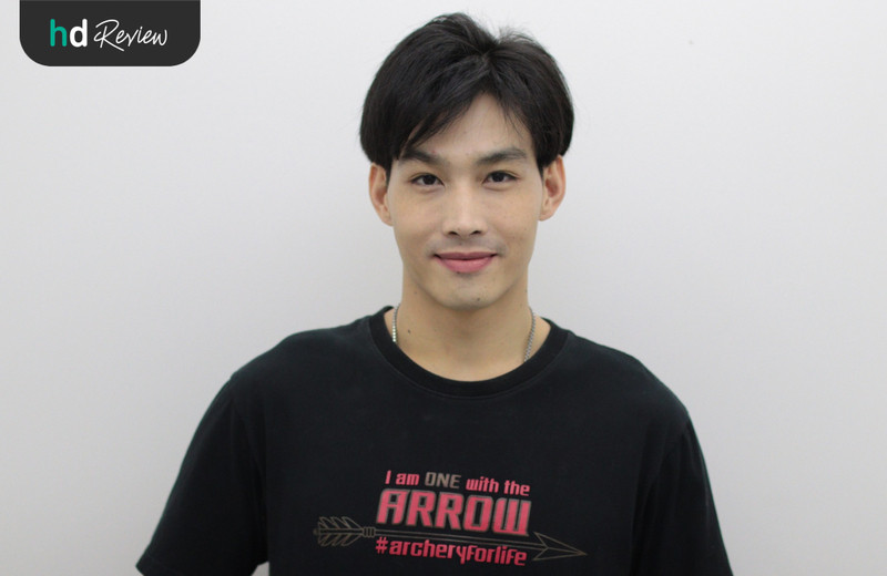 ผลลัพธ์หลังเลเซอร์รักษาฝ้า ด้วย Picocare 450 ที่ Flow Clinic