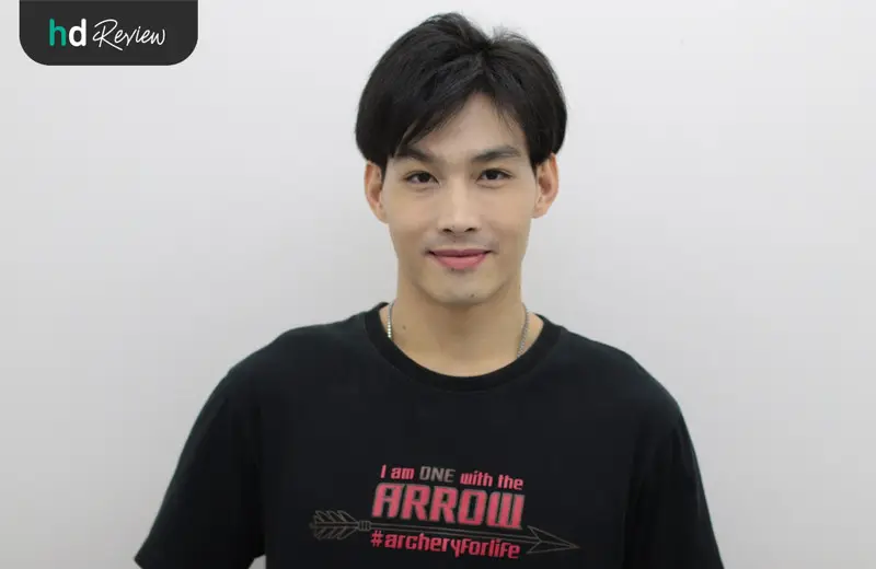ผลลัพธ์หลังเลเซอร์รักษาฝ้า ด้วย Picocare 450 ที่ Flow Clinic